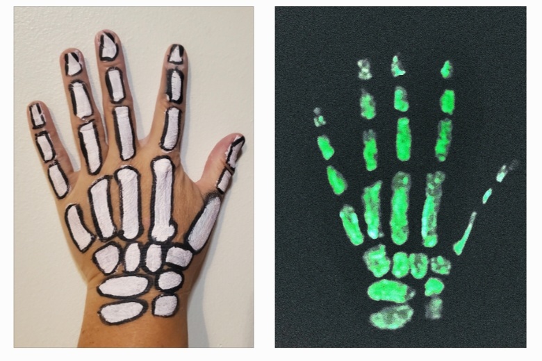 Bones